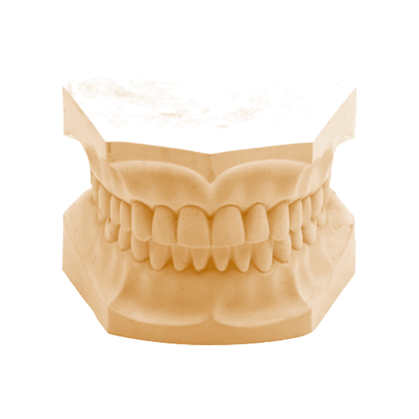 Gipsas IV klasės KKD VERADUR 03 06496, auksinis-rudas, 22.7 kg (1)