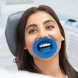 Žiodiklis OptraDam Plus Small, IVOCLAR, 1 vnt (3)